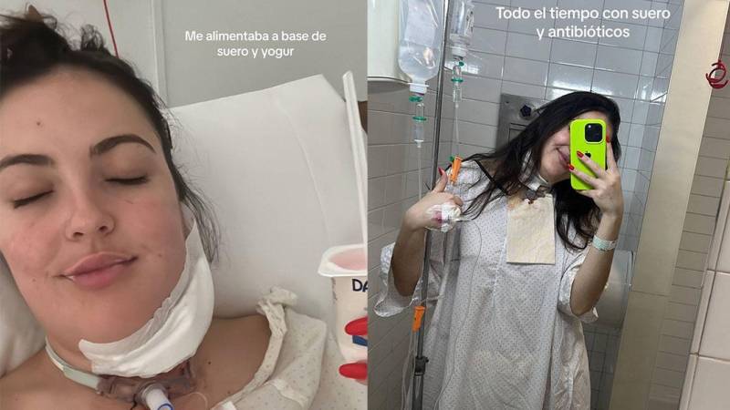 La mujer luego de realizarle la traqueotomía 