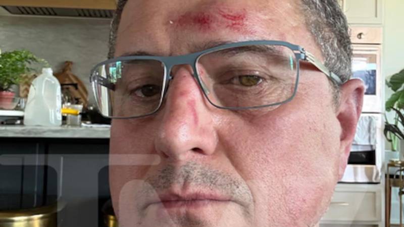 Ronnie Taylor, el vecino que fue golpeado por Ritchson