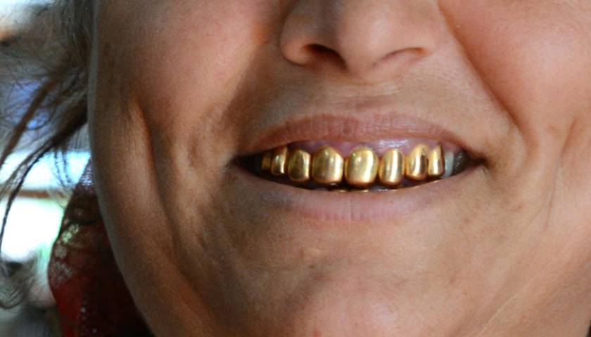 Roban hasta la placa dental de oro de una mujer de 78 años en Cochabamba 