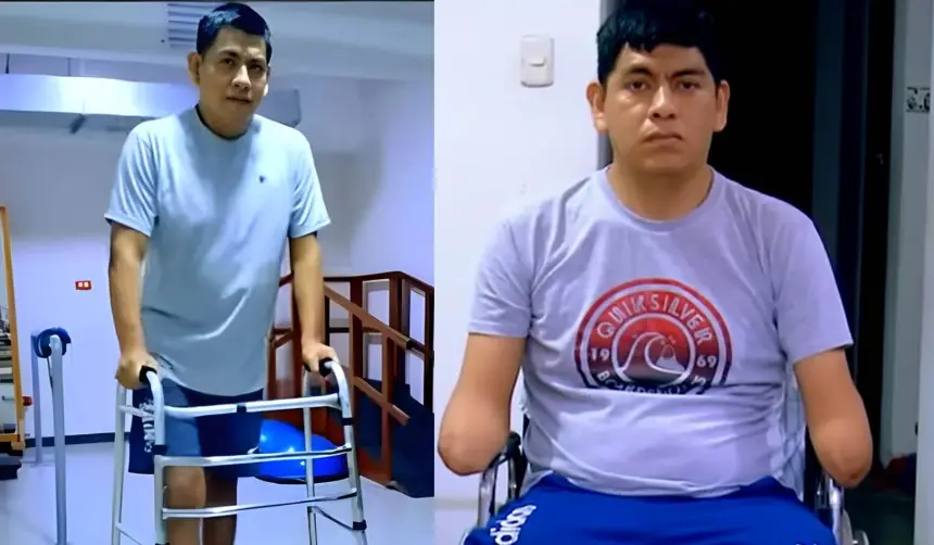 Video: Ingresó caminando a una operación para su rodilla y terminó con las cuatro extremidades amputadas