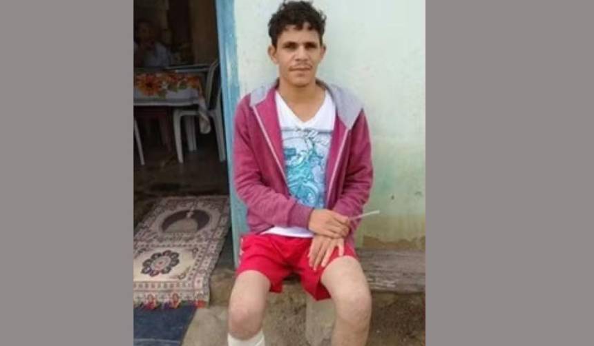 Se amputó un pie para recibir una ‘millonaria indemnización’ del seguro, pero fue condenado por la Justicia