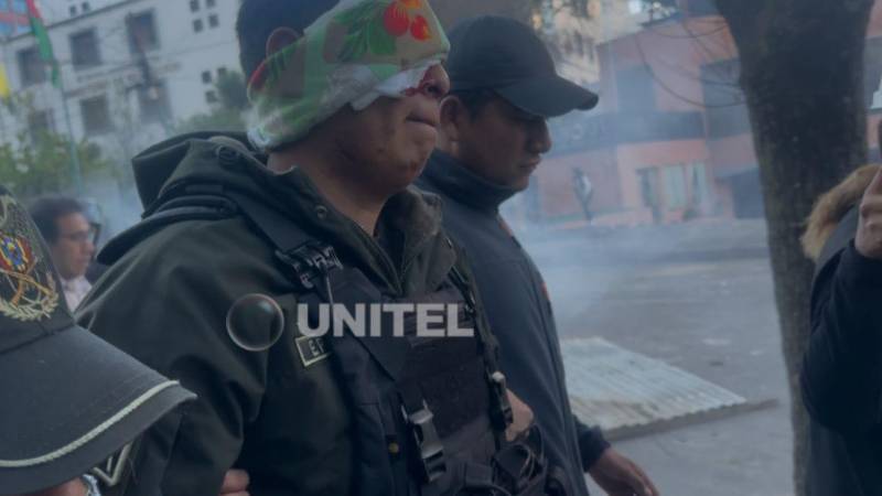 Uno de los policías heridos